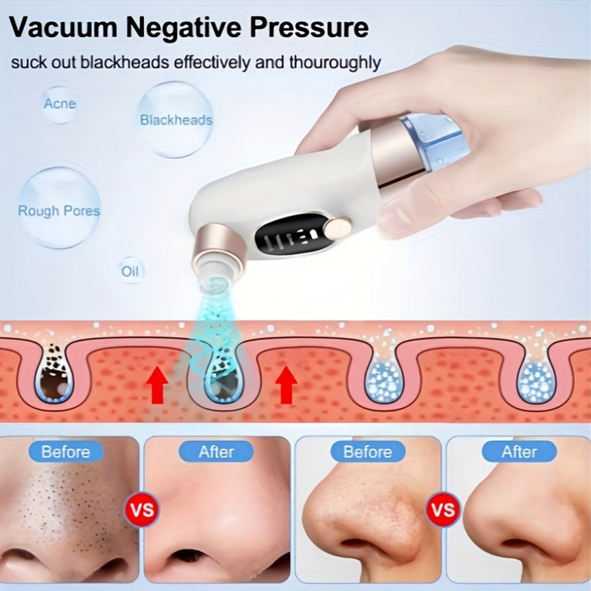 Erkaklar va ayollar uchun 3 tortish darajasi va 6 ta prob bilan qora nuqta olib tashlash uchun vakuum
