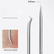 4-Piece Stainless Steel Pimple Extractor Kit for Blackhead and Whitehead Removal