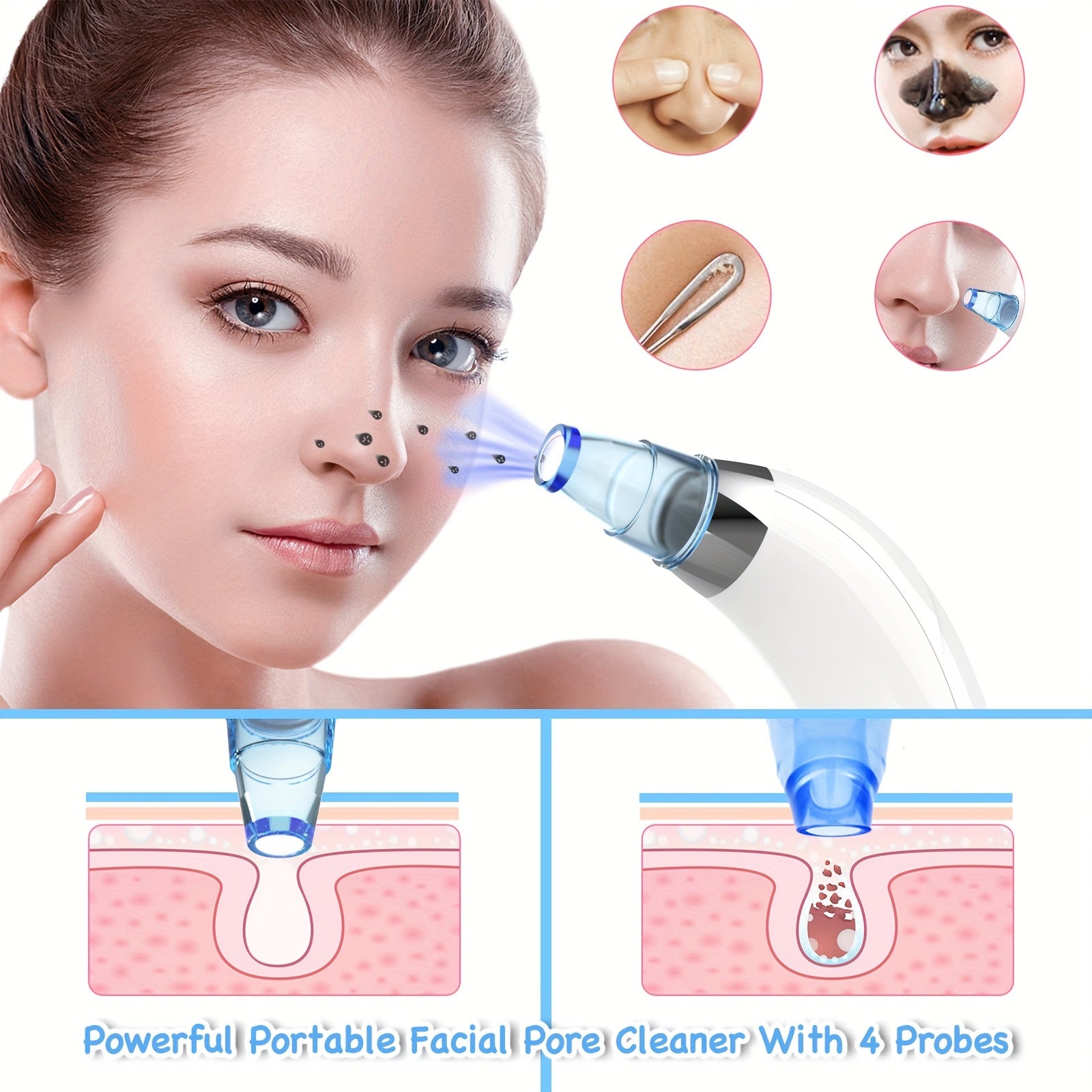 Herramienta para eliminar puntos negros con 4 sondas intercambiables, alimentada por batería, limpia poros para mujeres y hombres