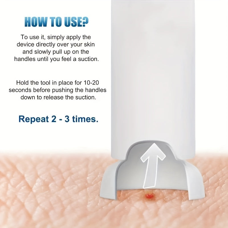 Moskito va hasharotlarning tishlaridan vakuum Stinger olib tashlash asbobi