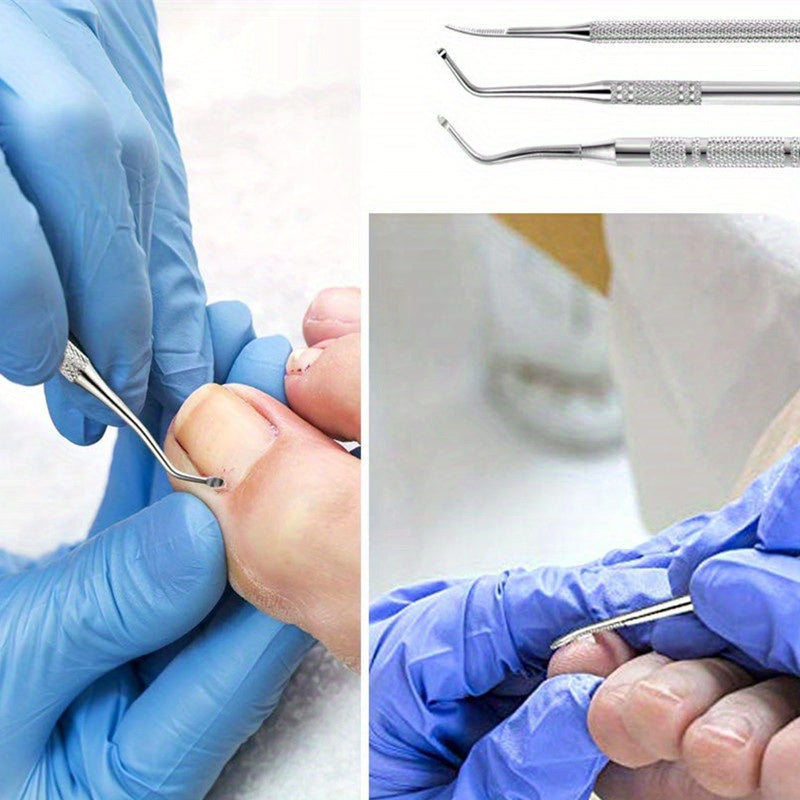 3pcs Stainless Steel Ingrown Toenail Tool Set Pedicure Nail Care Kit