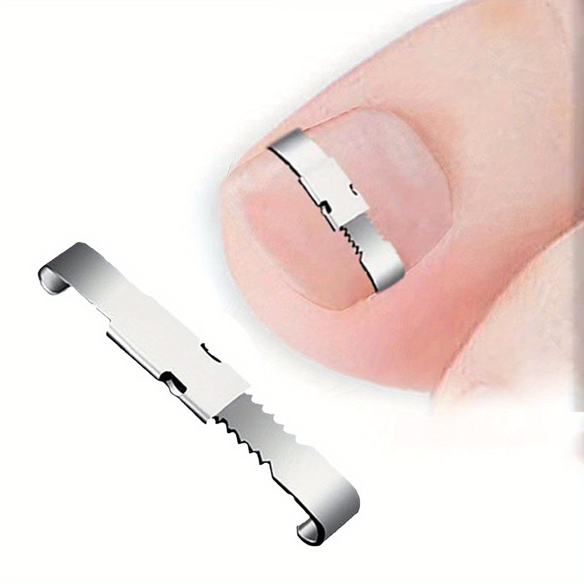 4 dona Ingrown Toenail Care Kit zanglamaydigan po'latdan yasalgan oyoq parvarishi to'plami