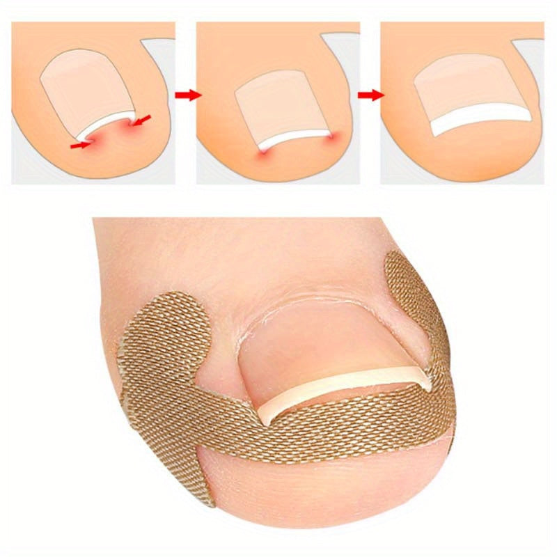 4PCS Ingrown Toenail Care Kit Stainless Steel Foot Grooming Set