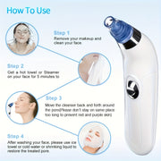 Portable Blackhead Vacuum Cleaner with 4 Nozzles, Gentle, Safe, Battery-Free