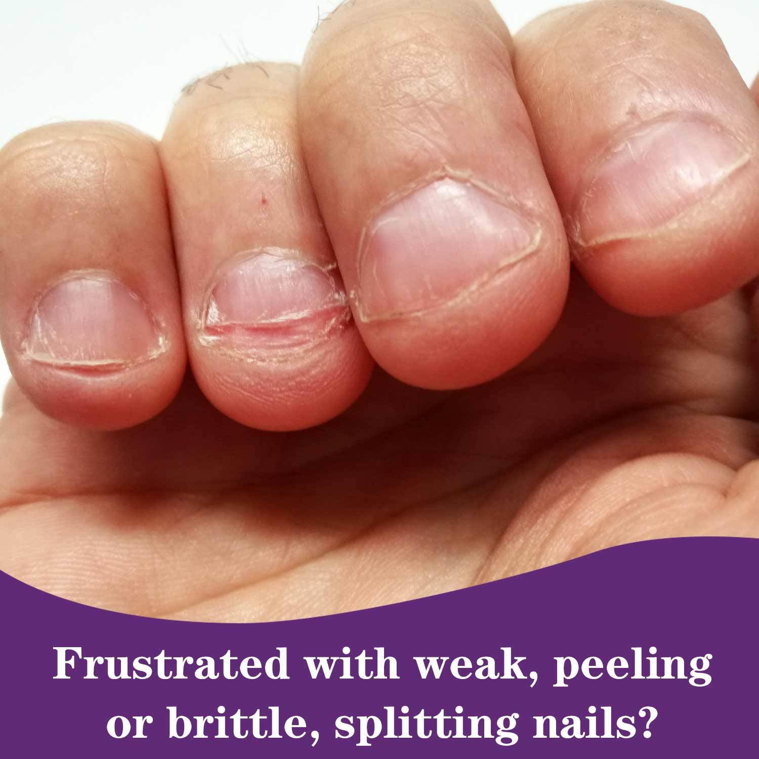 10ml Formaldehyde-Free Keratin Nail Strengthener for Repair and Protection