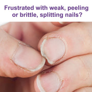 Women Nail Strengthening Serum 10ml Fills Brightens Protects Weak Nails