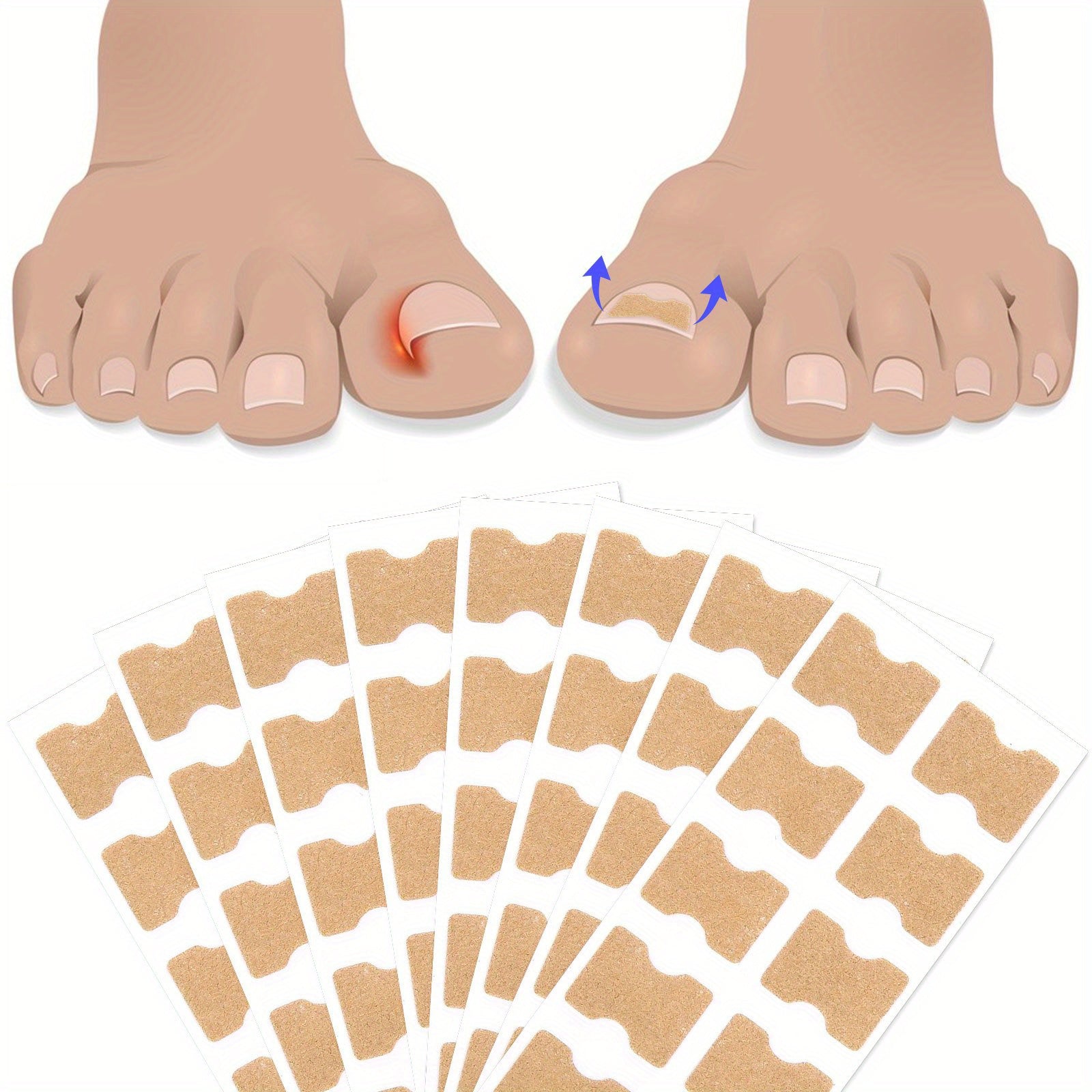 50PCS Odorless Nail Repair Patches for Ingrown and Thick Toenails