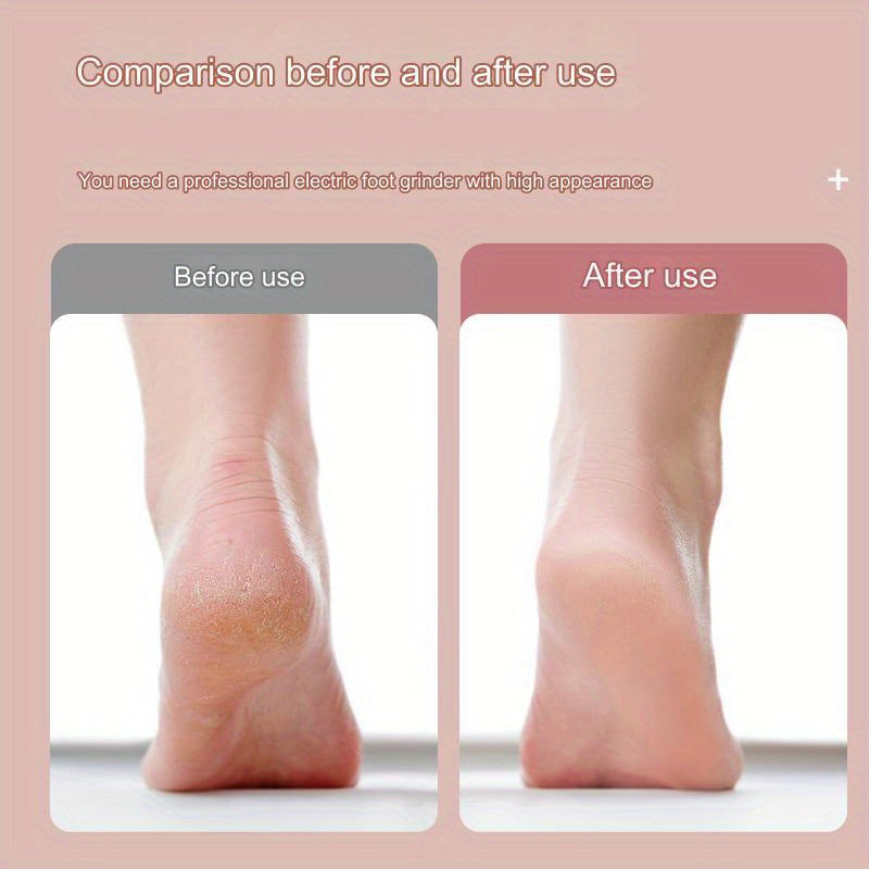 Rechargeable Cordless Foot Grinder for Exfoliation at Home or Travel