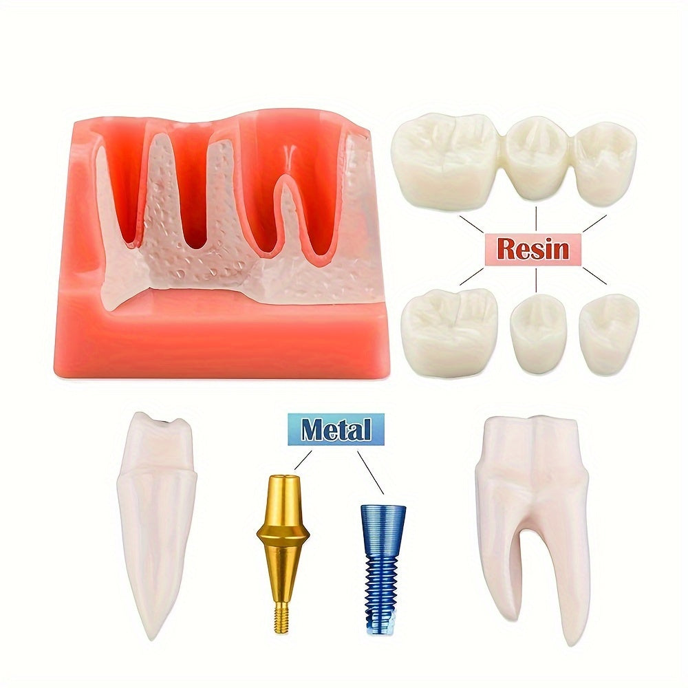 Removable Dental Implant Model with 4 Crown Bridges PVC Material for Education