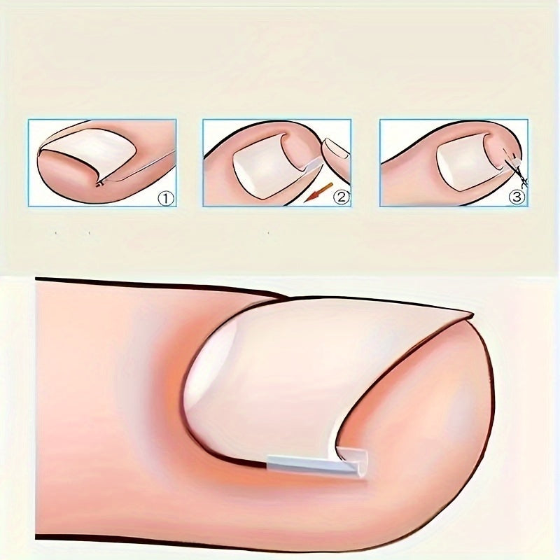 Oyoq parvarishi to'plami, ichki oyoq tirnoqlarini tuzatish uchun 10-100 ta asboblar to'plami