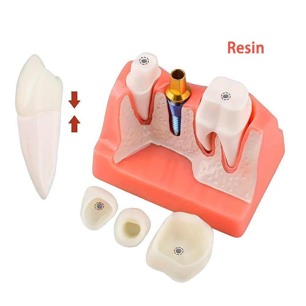 Removable Dental Implant Model with 4 Crown Bridges PVC Material for Education