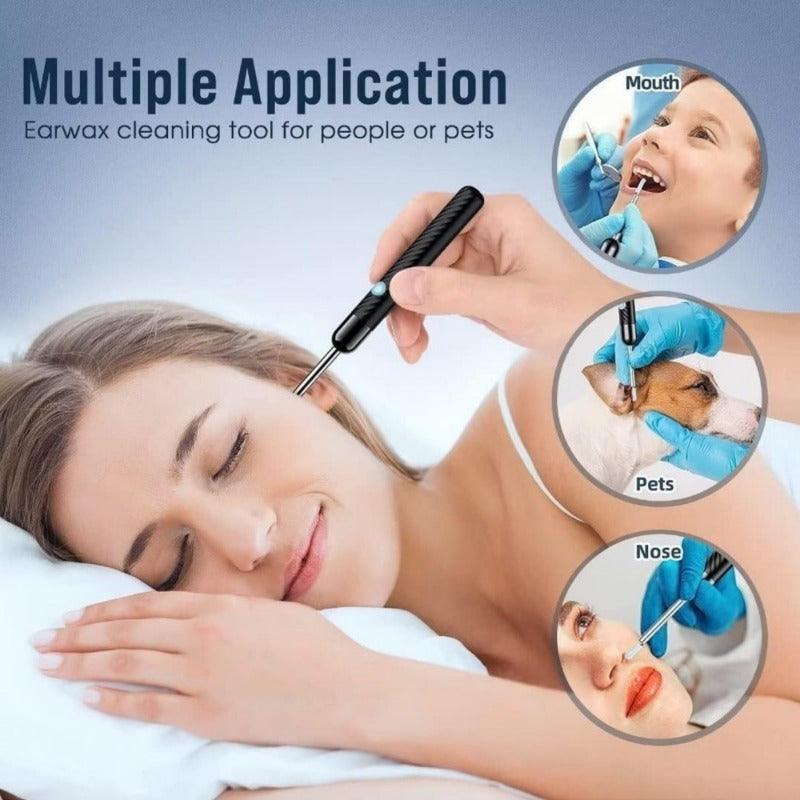 1080P HD Wireless Ear Wax Removal Kit with 6 Silicone Tips and 360° Panoramic View