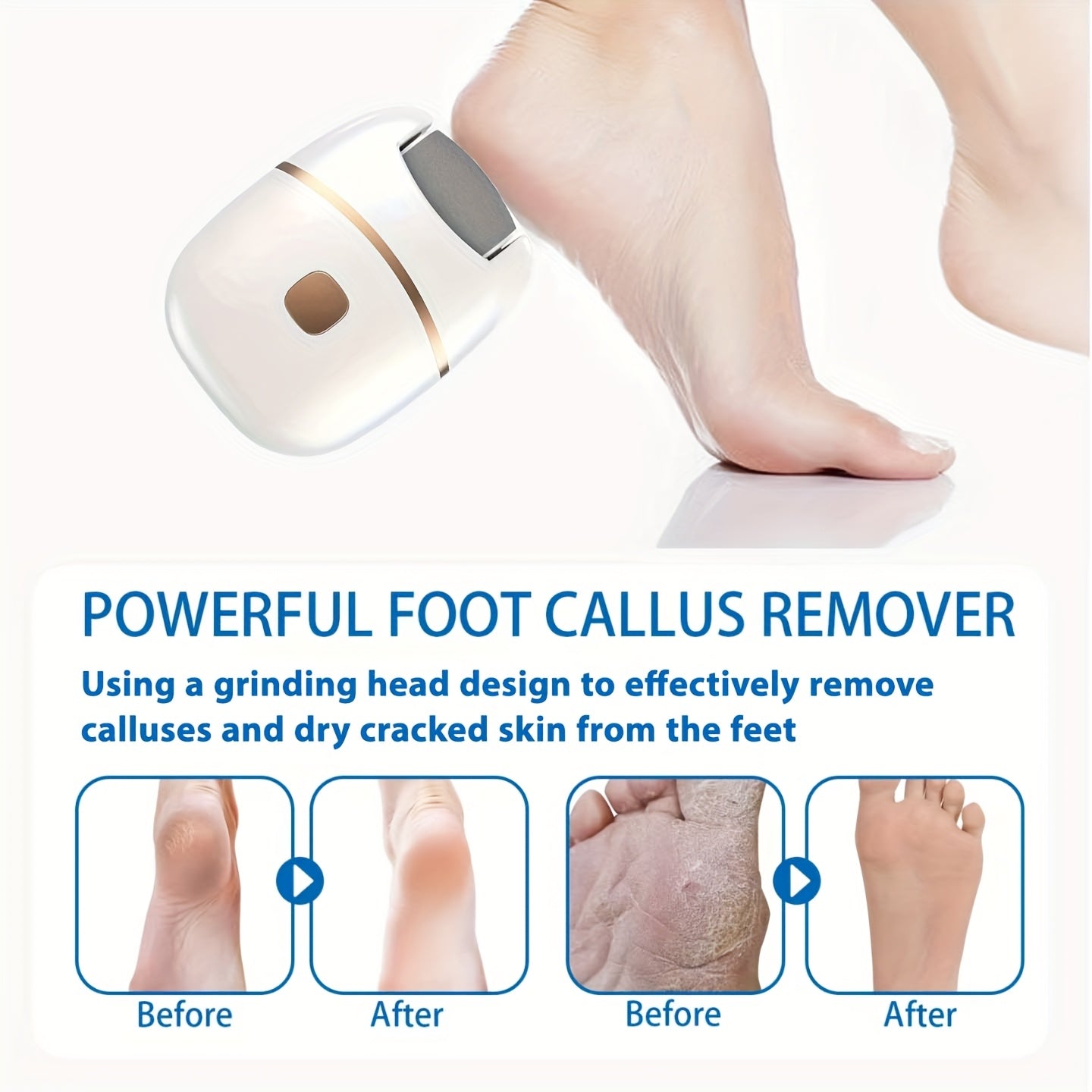 Portable Foot Grinder with 3 Replaceable Heads USB Rechargeable Callus Remover for Hard Skin