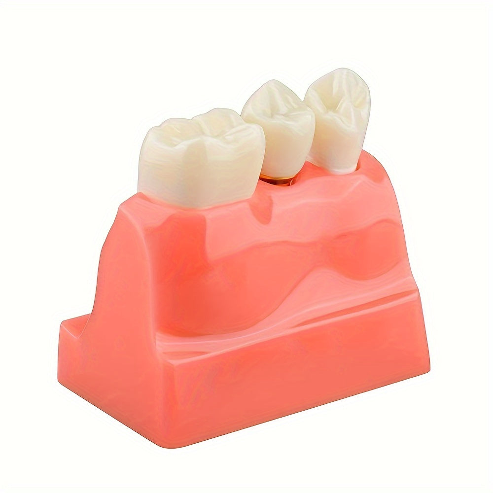 Removable Dental Implant Model with 4 Crown Bridges PVC Material for Education
