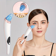 GENAI USB qayta zaryadlanadigan qora nuqta olib tashlovchi, elektr po'lat tozalovchi va uyda foydalanish uchun yuzni so'rish qurilmasi. 300mAh litiy polimer batareyasi bilan ta'minlangan, ≤36V ishlash voltaji.