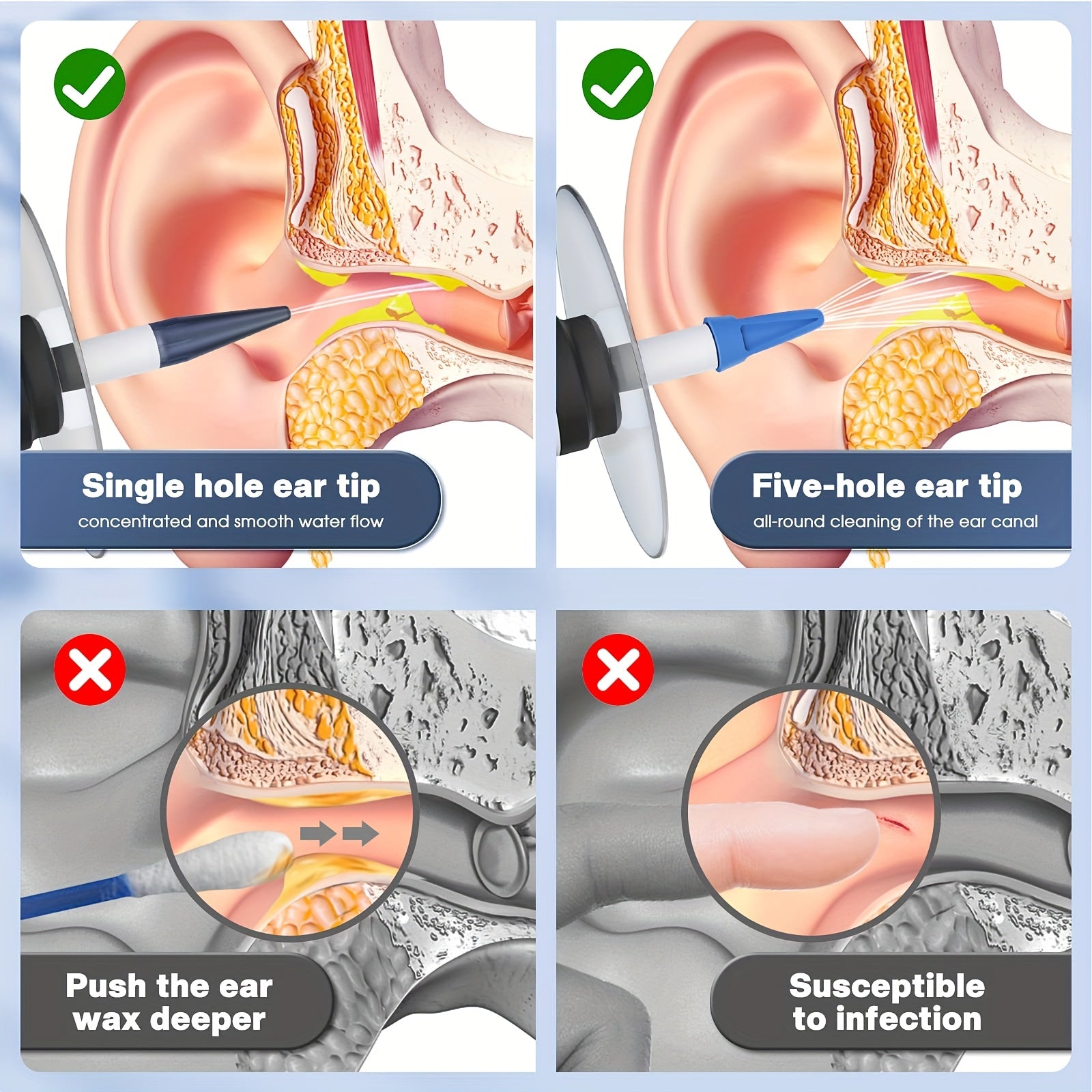 2025 yilgi Elektron Quloq Tozalash To'plami, quloq yuvish tizimi bilan, quloq shilliqni olib tashlash uchun xavfsiz va samarali. 10 ta bir martalik nozzle va kamera bilan quloq shilliqni olib tashlash vositasi kiradi.