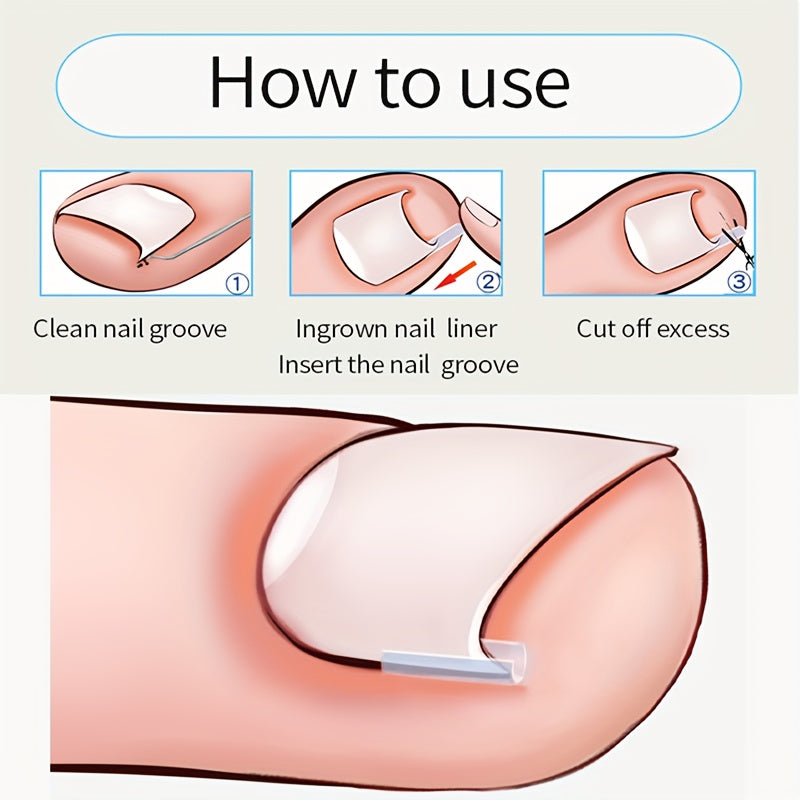 4PCS Ingrown Toenail Care Kit Stainless Steel Foot Grooming Set
