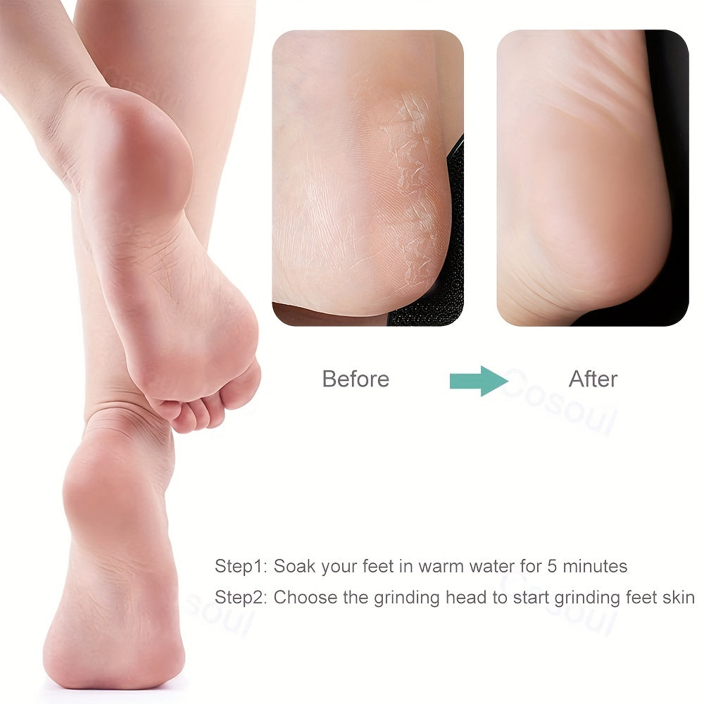 Rechargeable Electric Foot File Callus Remover for Dead Skin Heels with USB Charging and Multiple Grinding Heads