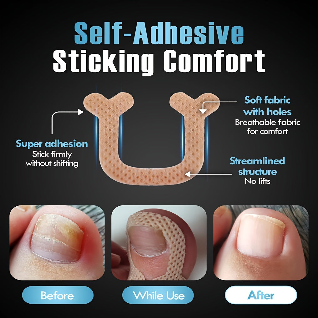 U-Shaped Nail Pads Breathable Fabric Toe Protectors Toe Nail Straightening Strips