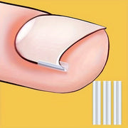 50 dona Tirnoq To'g'rilash Vositasi Tirnoq go'shti yopishtiruvchi to'g'rilovchi oyoq tirnoqlari uchun