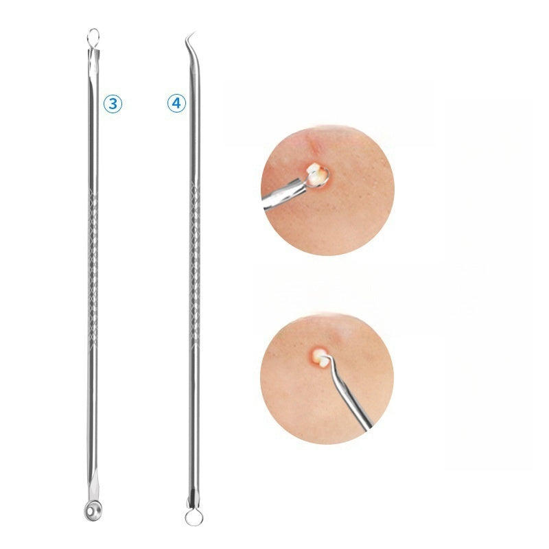 4-Piece Stainless Steel Pimple Extractor Kit for Blackhead and Whitehead Removal