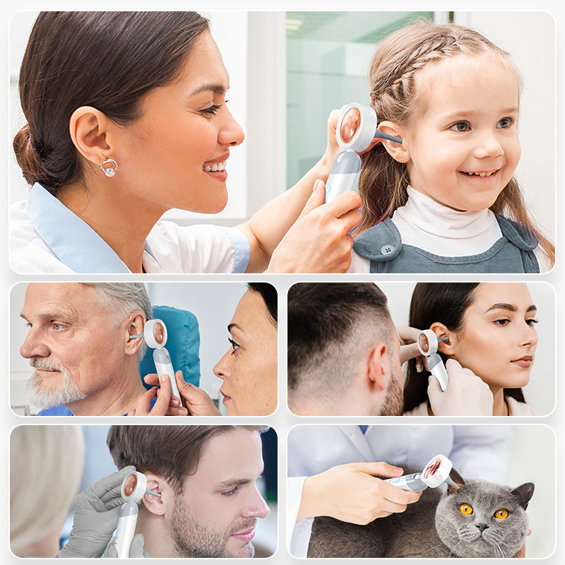 Smart Ear Canal Endoscope with 1080P HD Camera, 12 Accessories, Rechargeable Battery for Adults and Pets