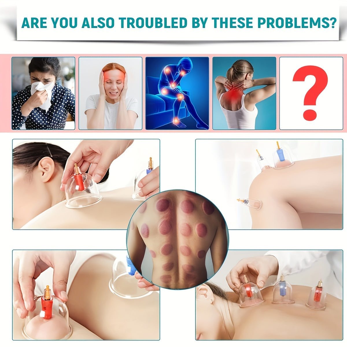 Bir nechta vakuum stakanlari, qo'l nasosi va massaj terapevtlari va Xitoy akupunkturasi uchun batafsil qo'llanma bilan massaj qozonlari to'plami. Vakuum so'rish bilan portativ.