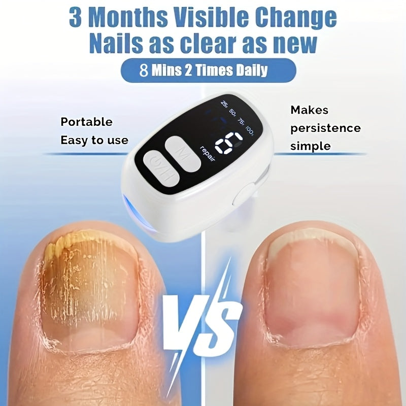 Portativ USB orqali zaryadlanadigan tirnoq parvarishlash qurilmasi, raqamli displey bilan, erkaklar va ayollar uchun mos. Sayohat uchun ideal, litiy polimer batareyasi bilan quvvatlanadi.