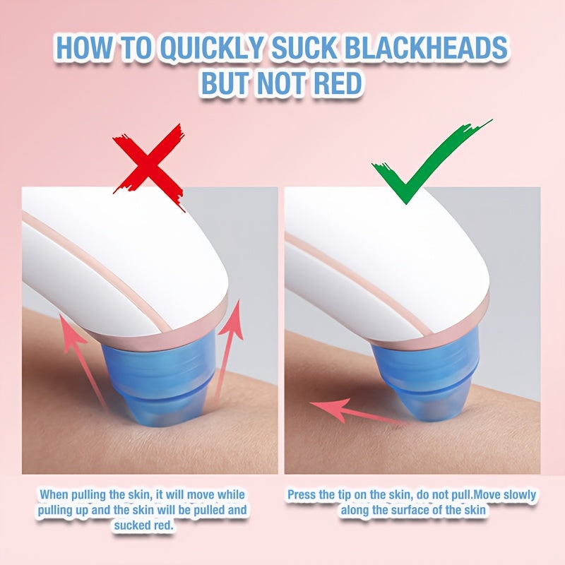 GENAI USB qayta zaryadlanadigan qora nuqta olib tashlovchi, elektr po'lat tozalovchi va uyda foydalanish uchun yuzni so'rish qurilmasi. 300mAh litiy polimer batareyasi bilan ta'minlangan, ≤36V ishlash voltaji.