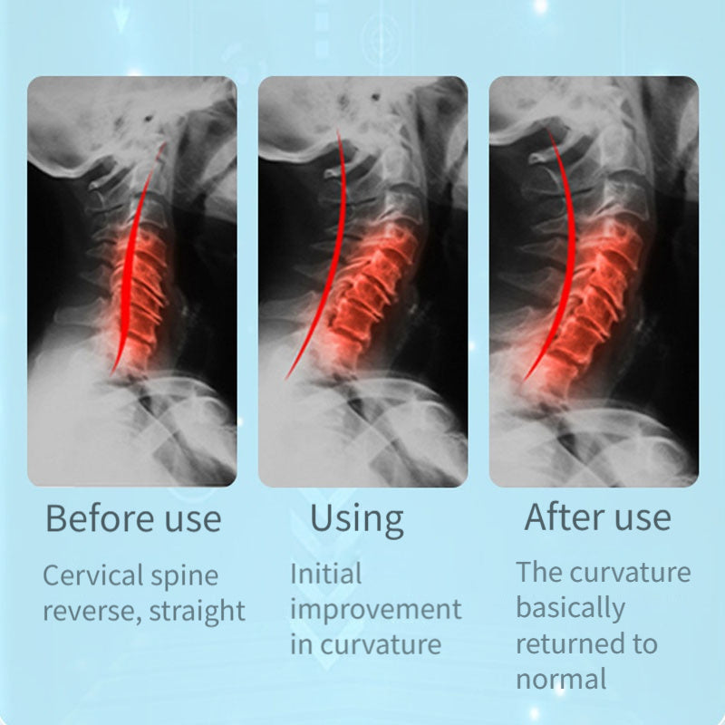 Bo'yinni qo'llab-quvvatlash, dam olish va taranglikni bartaraf etish uchun ergonomik bo'yin yostiq.