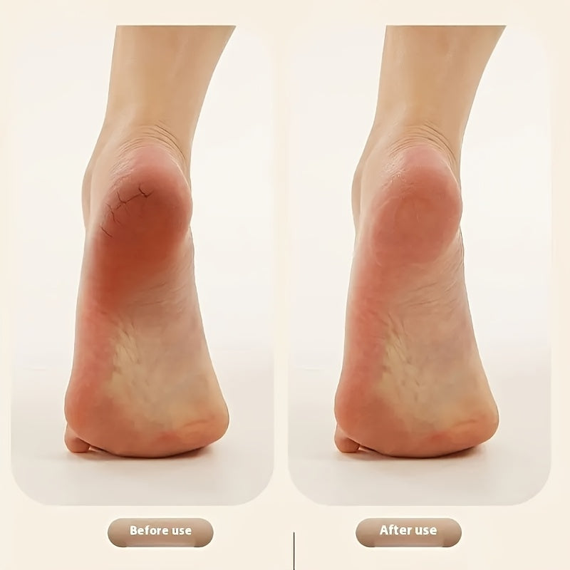 Elektr oyoq qattiq teri olib tashlovchi, almashtiriladigan soch olib tashlash boshiga va sozlanadigan tezlik nazoratiga ega, qulay foydalanish uchun USB orqali zaryadlanadi.