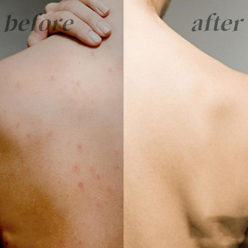 2 ta ergonomik dush qirqish uchun to'plam, tizzaga yopishmaydigan oyoq va orqa cho'tkalar bilan