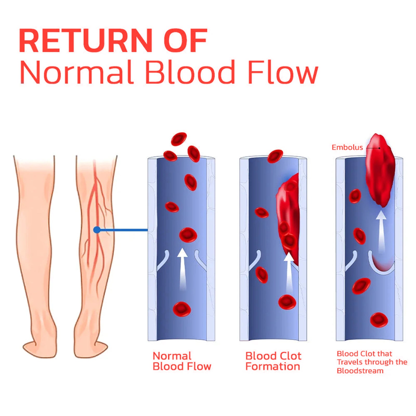 Foot Arch Insoles for Body Care and Slimming Non-slip Wear-Resistant Support