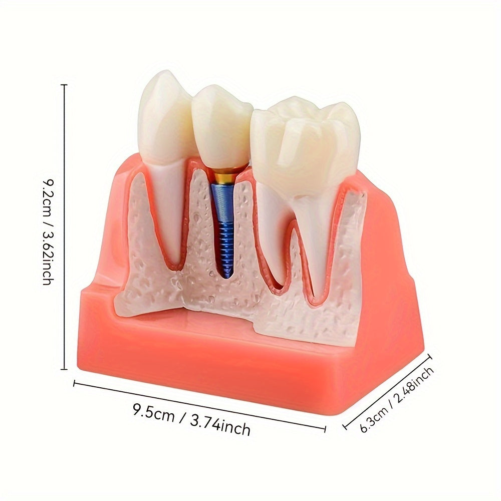 Removable Dental Implant Model with 4 Crown Bridges PVC Material for Education
