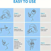 Uyda va sayohatda foydalanish uchun portativ tishlarni oqartirish to'plami, LED chiroq bilan, 4 ta parvarish geli, maxsus tadbirlar uchun ideal sovg'a.