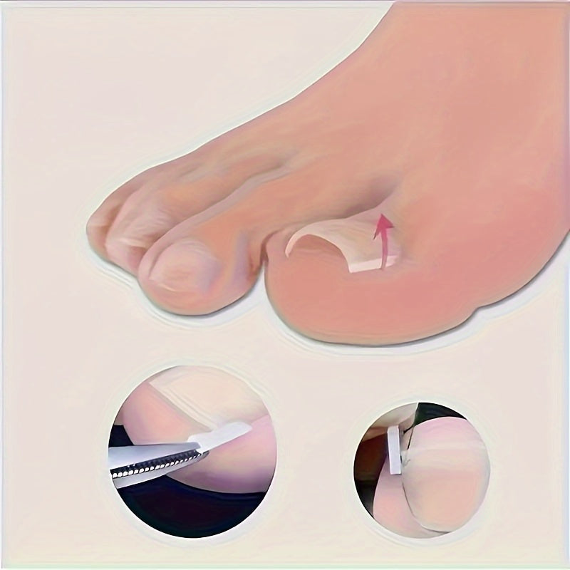 Oyoq parvarishi to'plami, ichki oyoq tirnoqlarini tuzatish uchun 10-100 ta asboblar to'plami