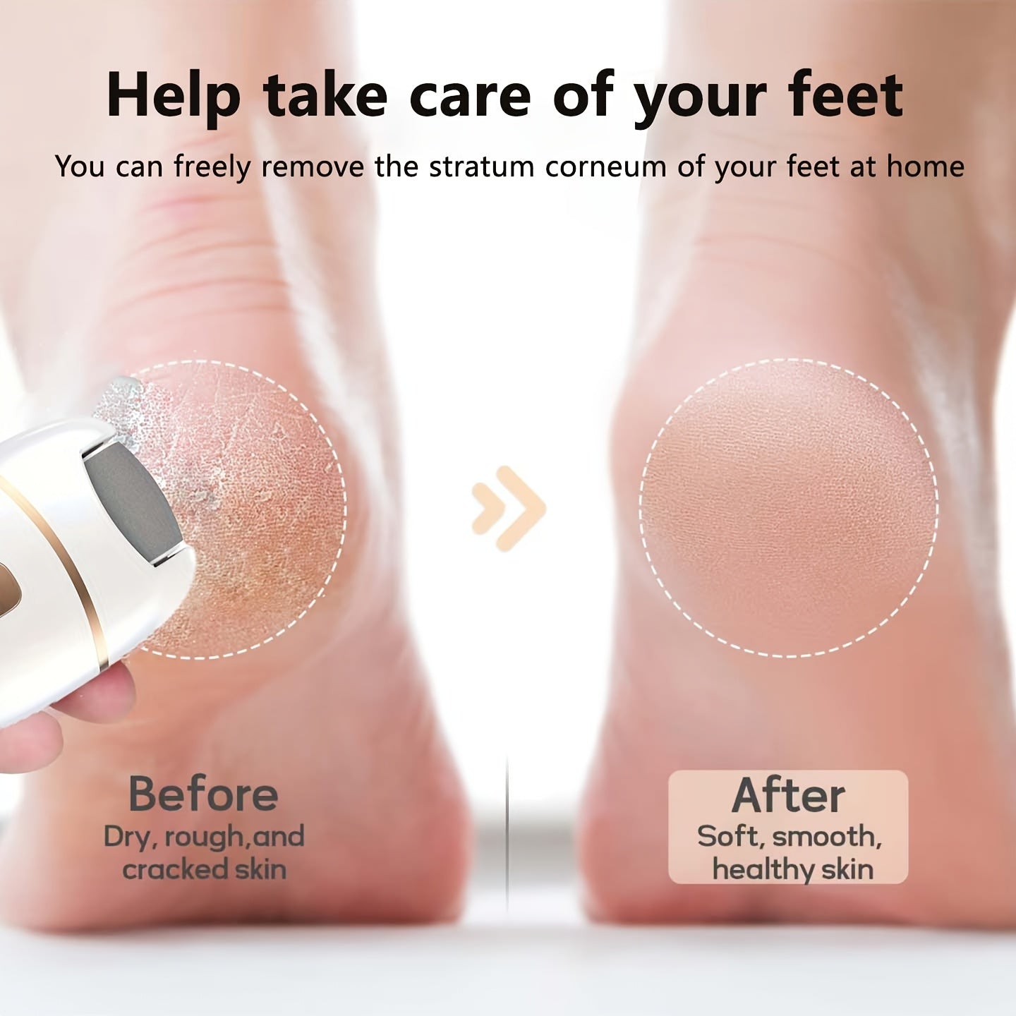 Portable Foot Grinder with 3 Replaceable Heads USB Rechargeable Callus Remover for Hard Skin