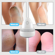 Rechargeable Electric Foot Grinder with Callus Remover and Heel Scraper USB Charging