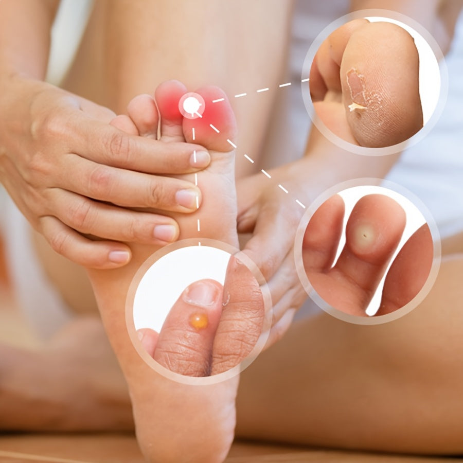 12 Pcs Silicone Toe Caps Protectors Cushions for Ingrown Nails and Friction