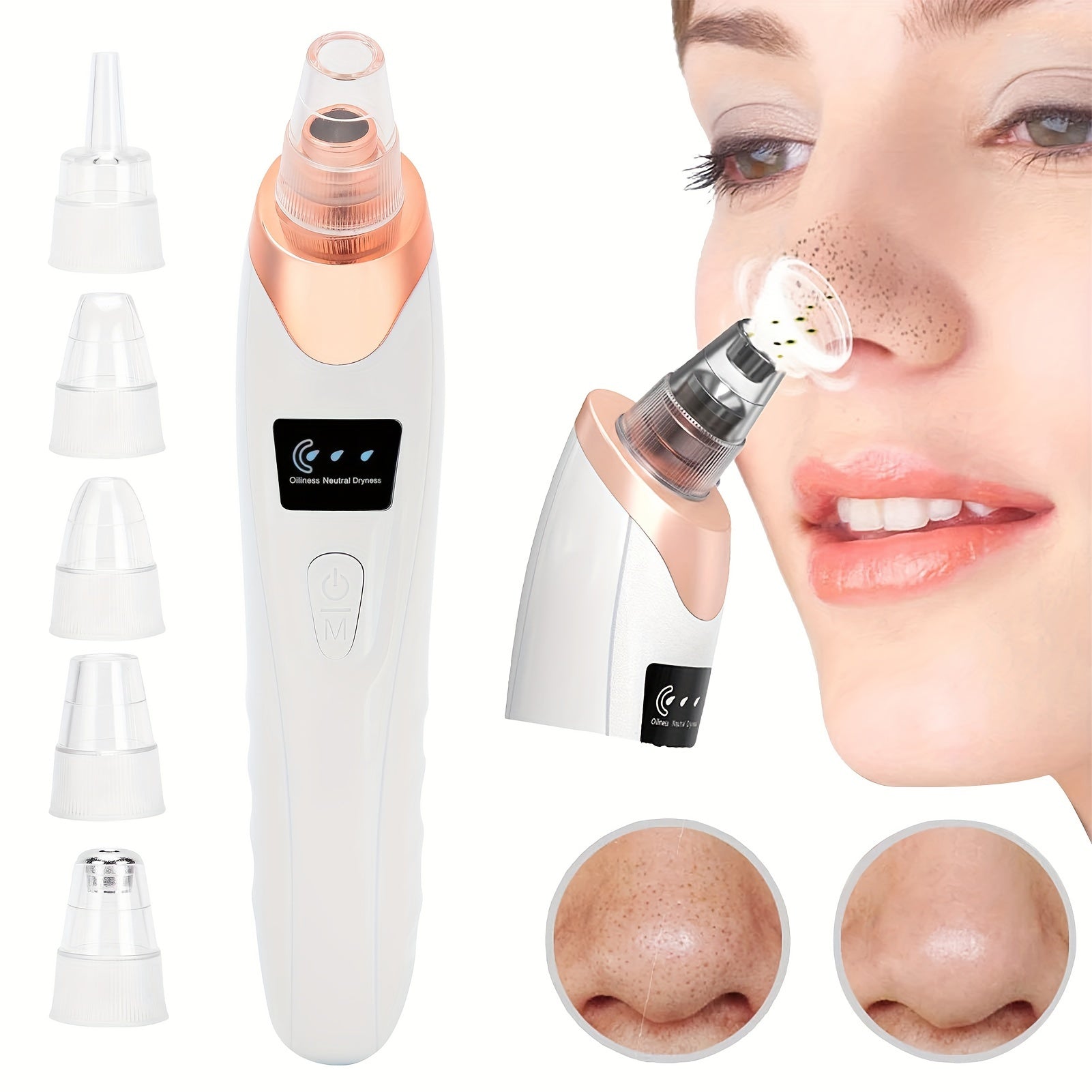 Blackhead Removal Tool for Men and Women with 3 Suction Powers and 5 Probes