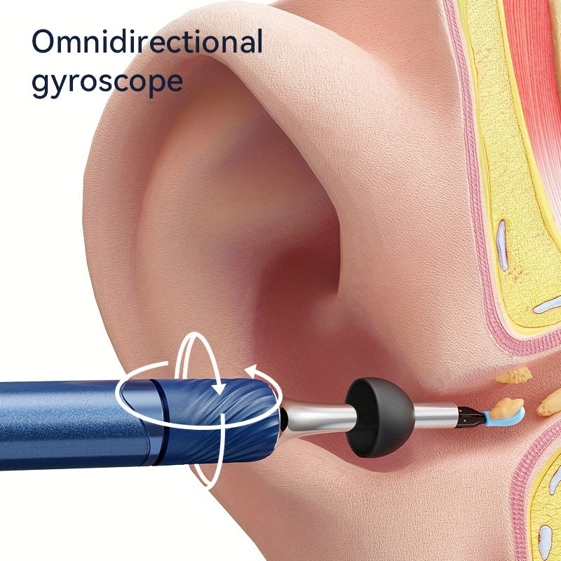 3-in-1 Smart Ear Wax Removal Kit with Camera Tweezers Spoon Rechargeable Battery Black White Blue