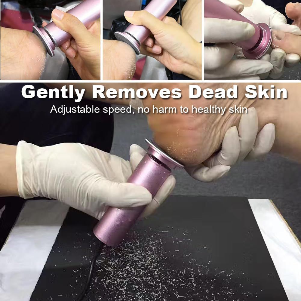 Electric Foot Callus Remover with Adjustable Speed and 30 Sanding Discs for Pedicure