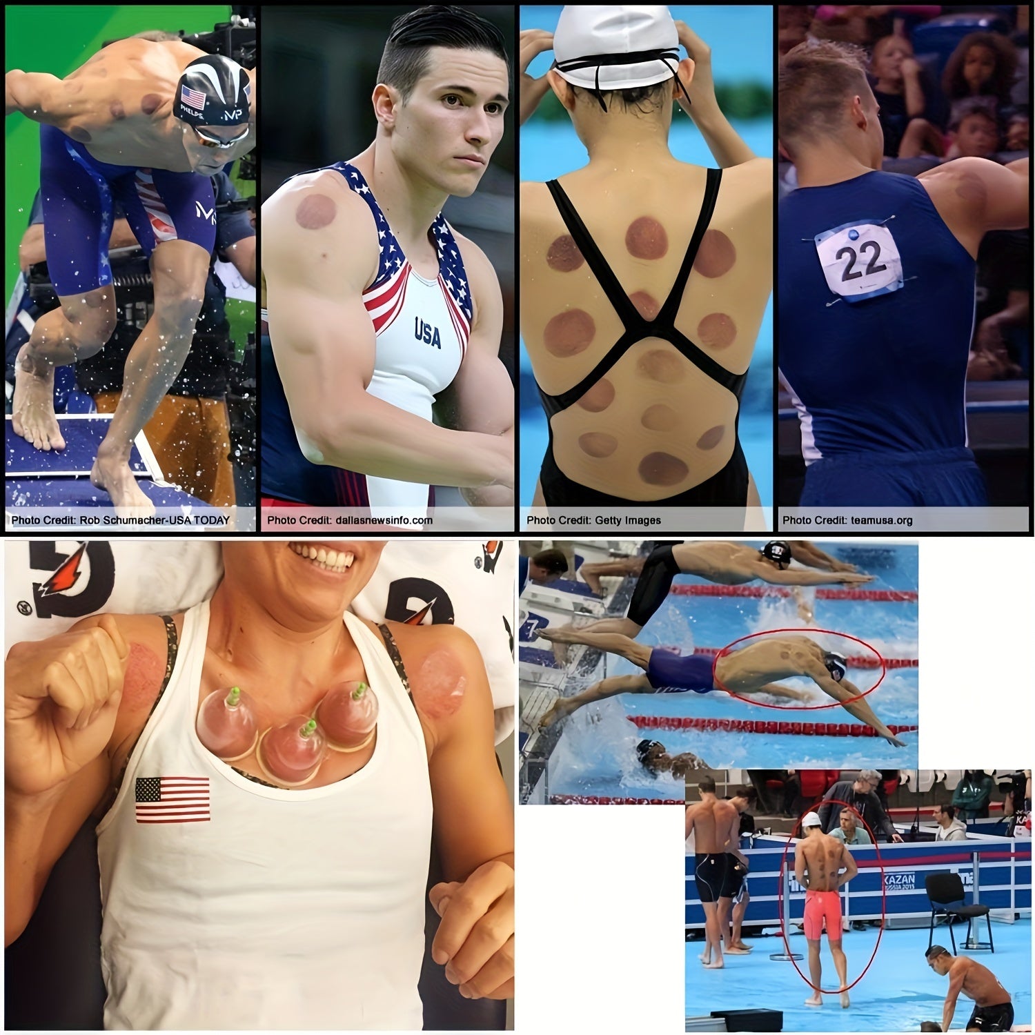 Cupping Massage Set for Whole Body at-Home Back Therapy