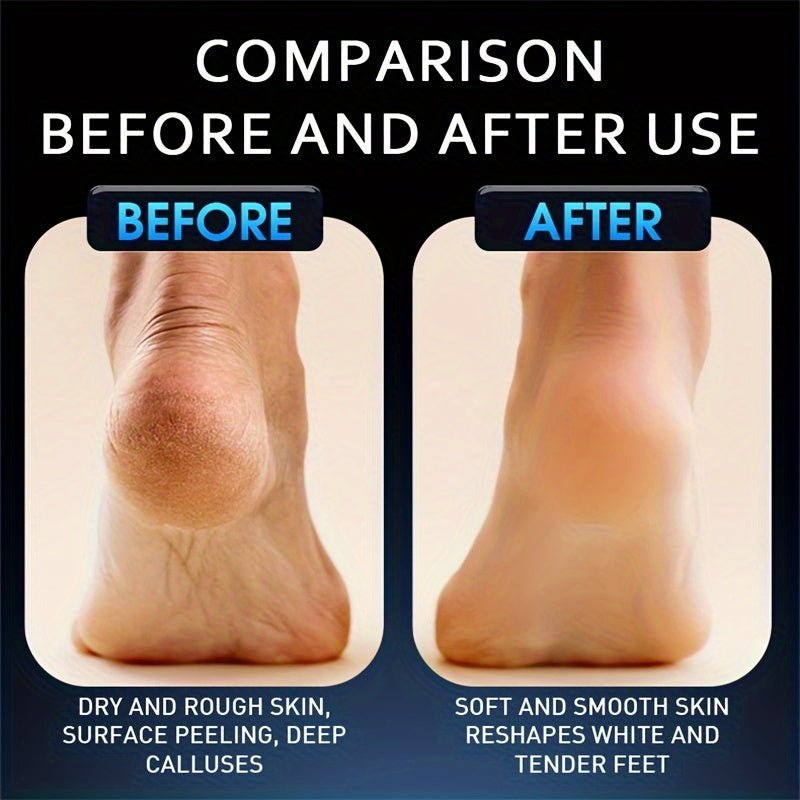 Rechargeable Electric Foot Grinder with Adjustable Speeds for Pedicure and Self-Care